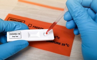 Tăng cường thanh, kiểm tra việc nhập khẩu, mua bán test kít xét nghiệm COVID-19